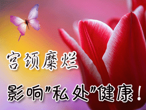 宫颈糜烂好治疗吗?