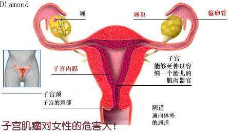 子宫疾病为什么会导致不孕?