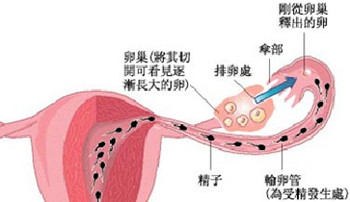 输卵管堵塞的原因有哪些?